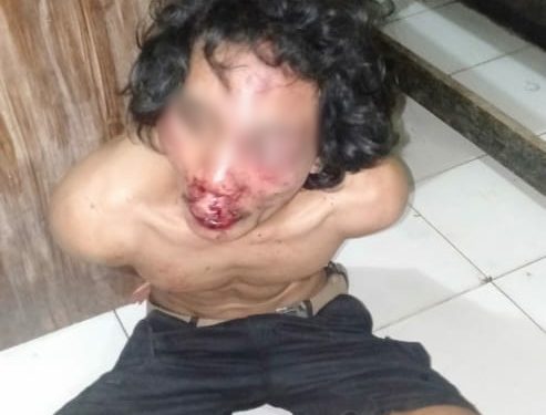 Nekat Merampok, Pemuda ini Nyaris Tewas Diamuk Warga