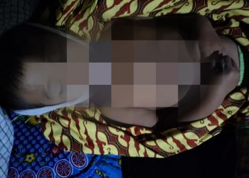 Tragis, Bocah Tiga Tahun Tewas Tersengat Listrik