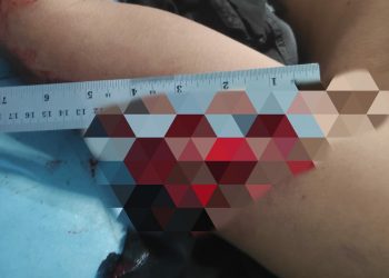 Ketua Pokdarwis Dibacok Preman Gegara Tak Diberi Jatah Bulanan
