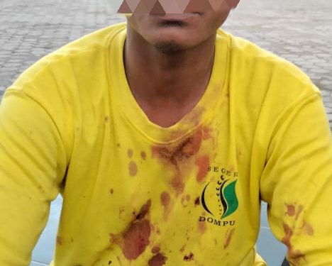 Buruh Jagung di Dompu Bacok Dua Security, Diduga Gegara Ditegur Saat Nyabu