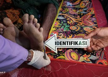 Pria 30 Tahun di Wera Bima Ditemukan Tewas Gantung Diri