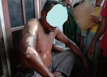 Gegara Ikan Goreng, Istri di Bima Siram Suaminya Dengan Minyak Panas