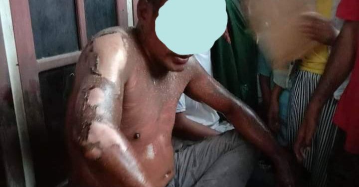 Gegara Ikan Goreng, Istri di Bima Siram Suaminya Dengan Minyak Panas