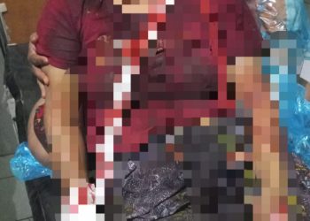 Sadis! Suami ini Tega Bacok Istri Sendiri