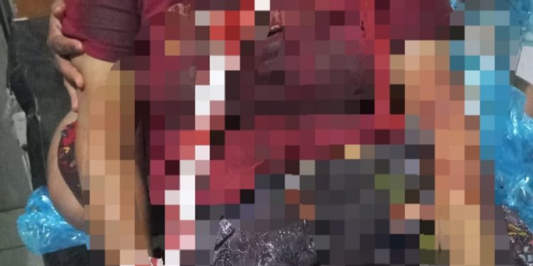 Sadis! Suami ini Tega Bacok Istri Sendiri