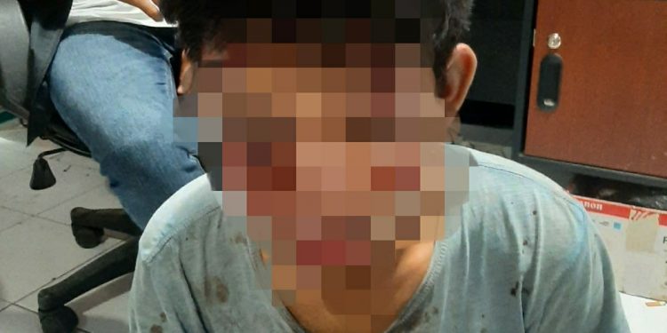 Curi Motor dan Bacok Korban, Pemuda ini Babak Belur Dihajar Warga